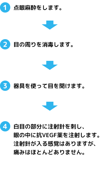 抗VEGF硝子体内注射の方法(解説)